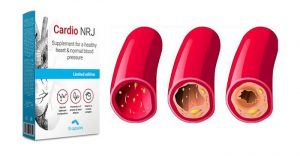 Cardio-NRJ-hol-kapható-gyógyszertár